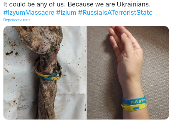Podría ser cualquiera de nosotros: los ucranianos están extendiendo sus manos con un brazalete de pasas azul y amarillo en línea 