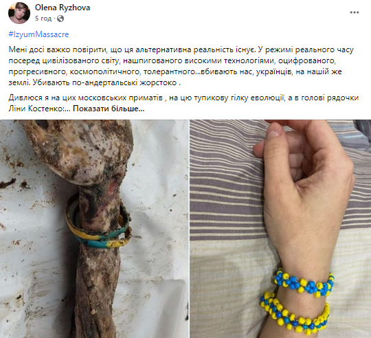 Podría ser cualquiera de nosotros: los ucranianos en la red abren las manos con pulsera azul-amarilla de pasas