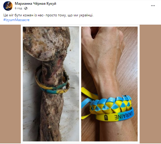 Podría ser cualquiera de nosotros: los ucranianos están extendiendo sus manos con un brazalete de pasas azul y amarillo en línea