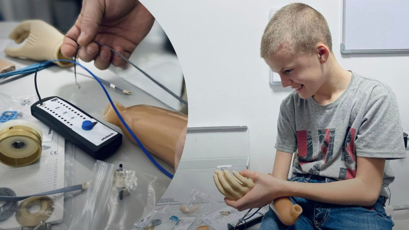 Los médicos de Lviv instalarán una prótesis a un niño de 13 años cuyo padre está en guerra 