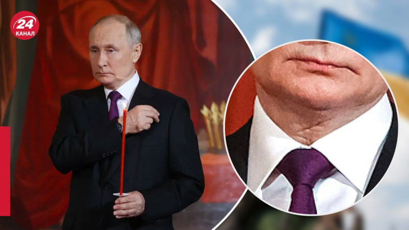 La cicatriz de Putin en el cuello desató una ola de rumores sobre su salud, – New York Post 