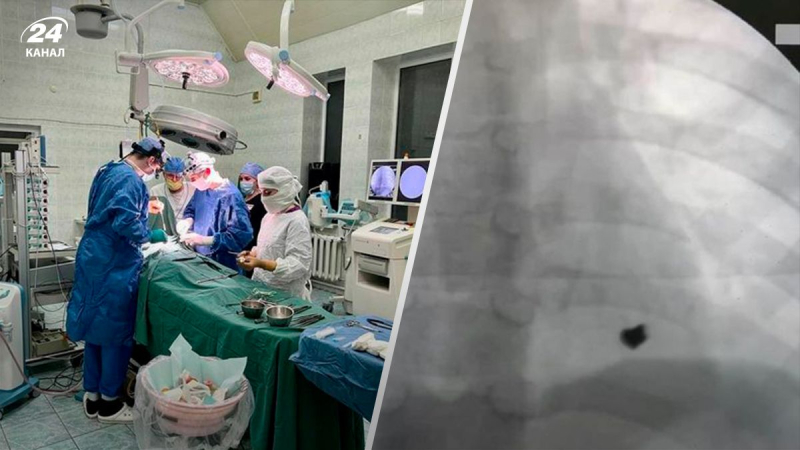 El juego infantil terminó con una bala en el corazón en la región de Odessa: los médicos salvaron al niño