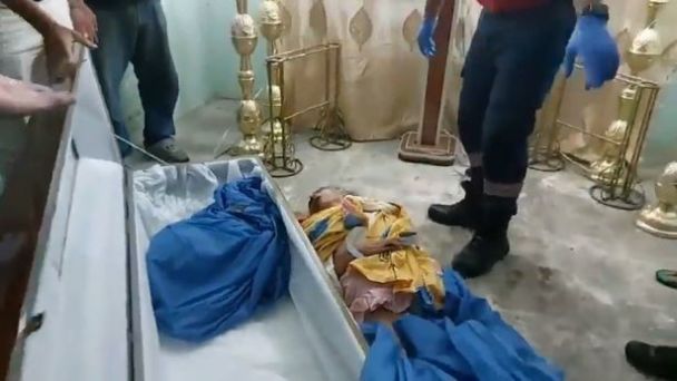Médicos declarados muertos: una mujer revivió milagrosamente en un ataúd antes del funeral ( foto)