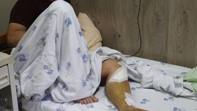 Odessa bombardeo: un niño de 17 años herido en el pecho – en una condición grave estable