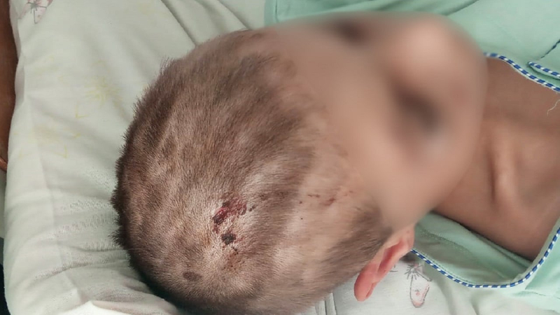 Cortar el cabello y golpear: en la región de Chernihiv, un hombre torturó a una mujer y niños durante una semana por cuatro duraznos