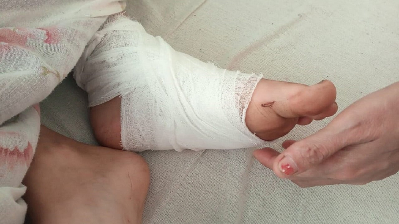 Cortar el pelo y golpear: en la región de Chernihiv, un hombre torturó a una mujer por cuatro duraznos durante una semana y niños