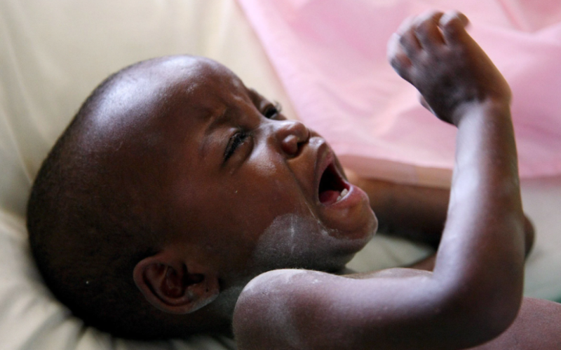 Una enfermedad terrible en los bebés de Uganda: de qué mueren los niños