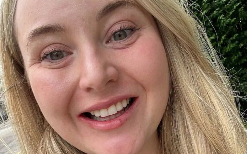 Mujer con "piel de marfil" quedó impactada por una alergia a las carillas; foto sorprendida por la historia de una reacción alérgica a las carillas, en las que gastó más de $ 1,200.</p>
<p>Esto está escrito por nypost.com. </p>
<p>Lily Lindsay, de 29 años, decidió someterse al procedimiento después de toda una vida avergonzada de su sonrisa, especialmente de sus dos dientes frontales. En agosto del año pasado, finalmente hizo realidad su sueño. -na-viniry-foto-2d20c9a.jpg” alt=”La mujer de "piel de marfil" quedó impactada por la alergia a las carillas — foto” /></p>
<p>Quedó encantada con el resultado del procedimiento, pero dos semanas después sucedió algo que cambió su vida. Debido a las carillas, su piel se volvió muy seca y escamosa, como la piel de un elefante. Ningún médico pudo ayudarla, por lo que la mujer tuvo que tomar antidepresivos.</p>
<p><img decoding=