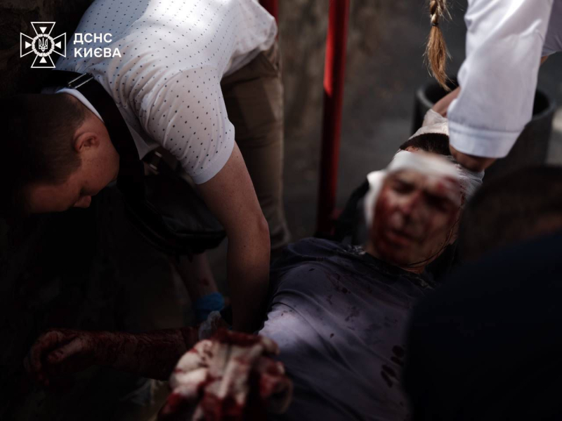 Explosiones en Kiev el 8 de julio: el número de muertos aumentó a 34 people